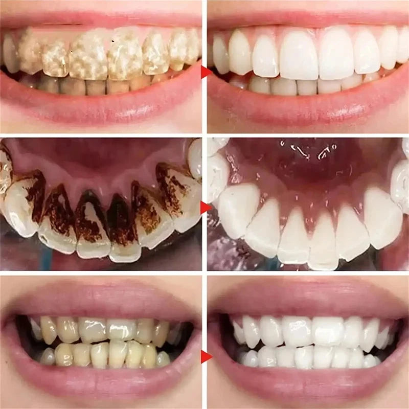 V34 5D Teeth Whitening Toothpaste