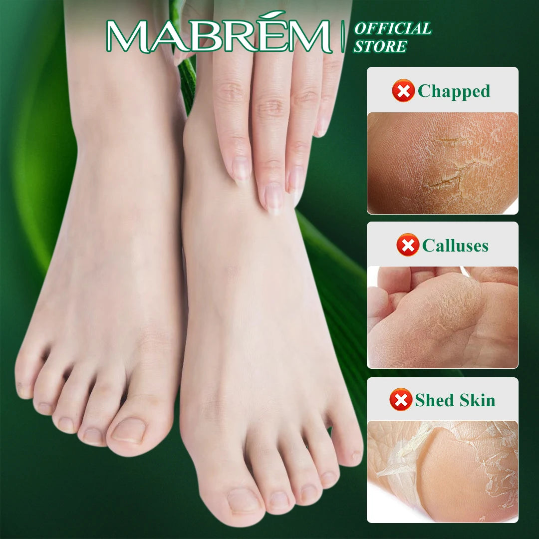 MABREM Foot Treatment Cream (Whitening, Anti-cracking, Moisturizing, Relive Pain)