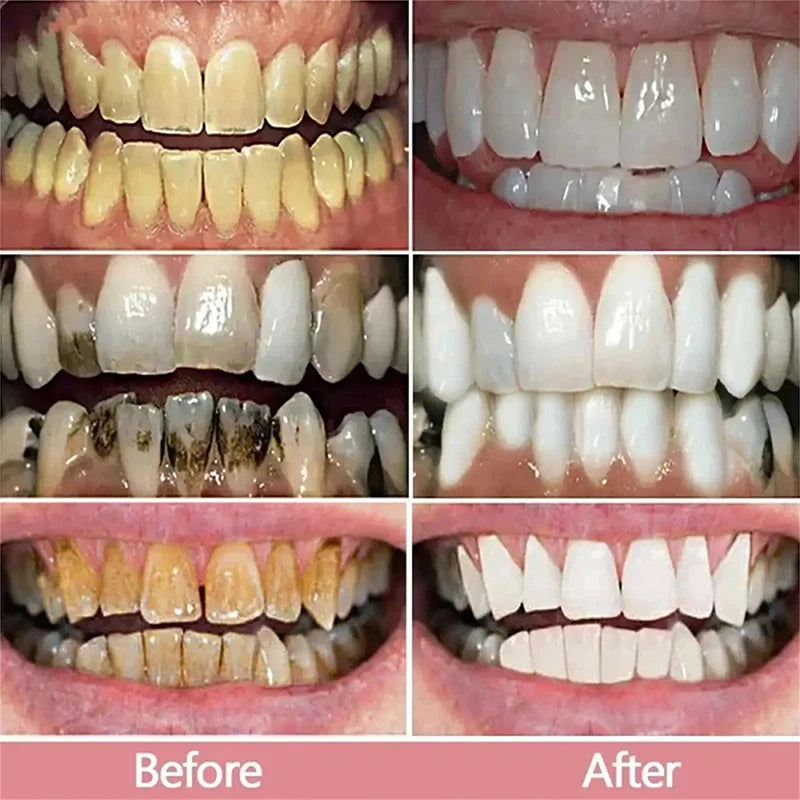 V34 5D Teeth Whitening Toothpaste