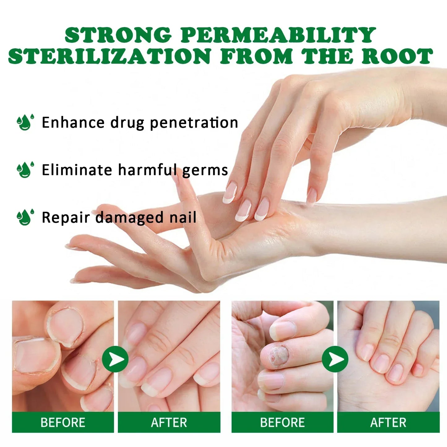 7 Days Nail Fungal Treatment Essence Oil Foot