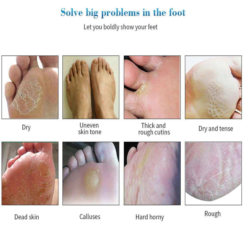 Electric Foot File Grinder – Callus & Dead Skin Remover, SPA Exfoliating Tool for Hard, Cracked Skin Care