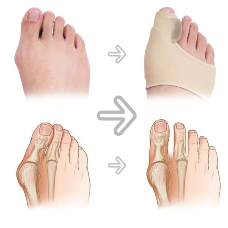 Orthopedic Toe Corrector & Bunion Straightener – Soft Alignment Socks for Foot Care & Pain Relief (1 par)