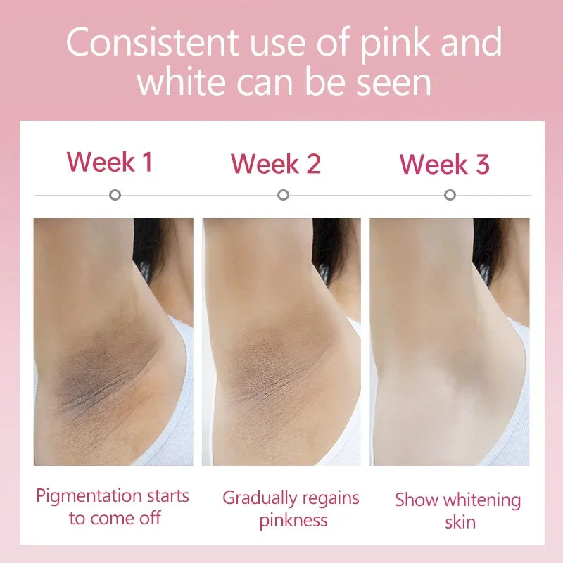 Whitening Cream for Dark Skin – Lightening & Brightening for Armpits, Thighs, Inner Joints, and Intimate Areas