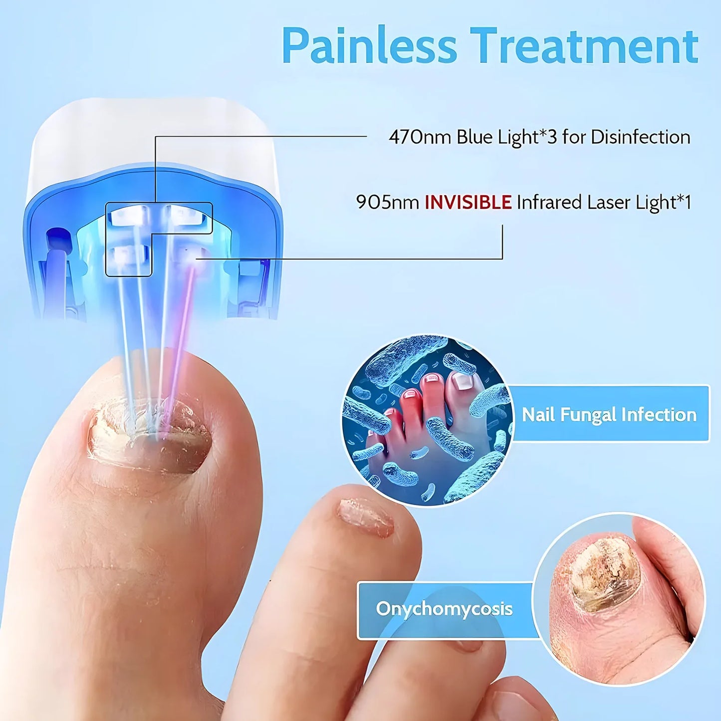 Nail Fungus Treatment Tool