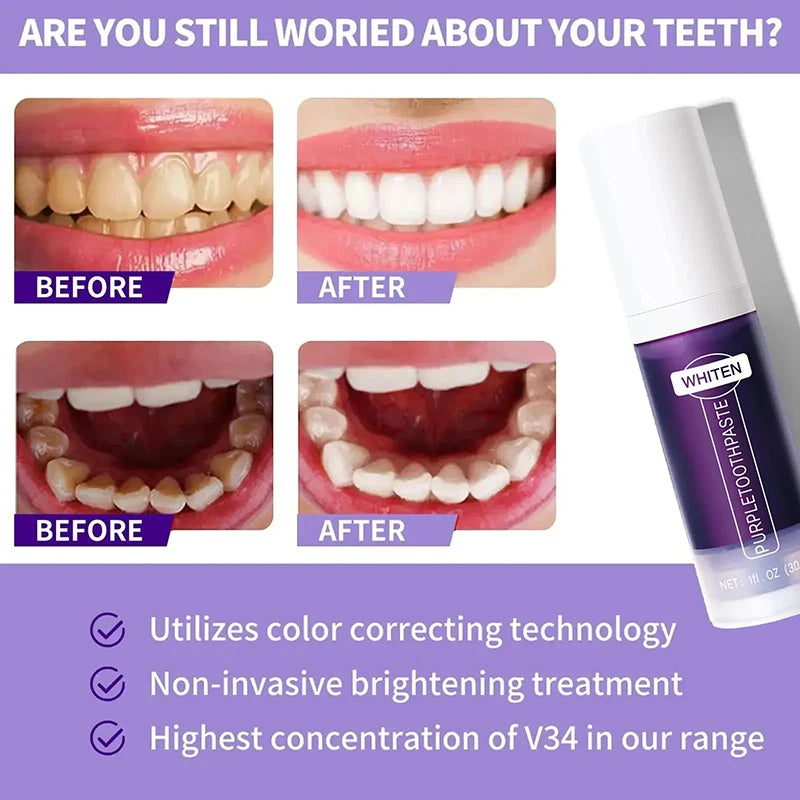 V34 5D Teeth Whitening Toothpaste