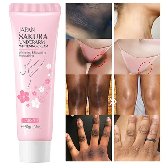Whitening Cream for Dark Skin – Lightening & Brightening for Armpits, Thighs, Inner Joints, and Intimate Areas