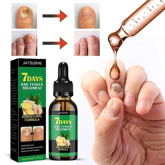 7 Days Nail Fungal Treatment Essence Oil Foot