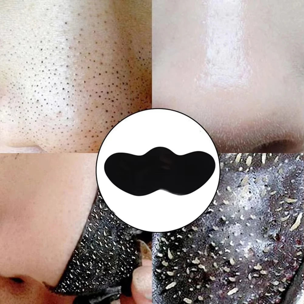 Facial Blackhead Removal Stickers – Pore & Nose Cleansing, Gentle Deep Care (10/50/100 Pieces)