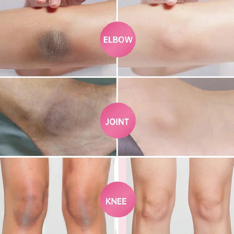 Whitening Cream for Dark Skin – Lightening & Brightening for Armpits, Thighs, Inner Joints, and Intimate Areas