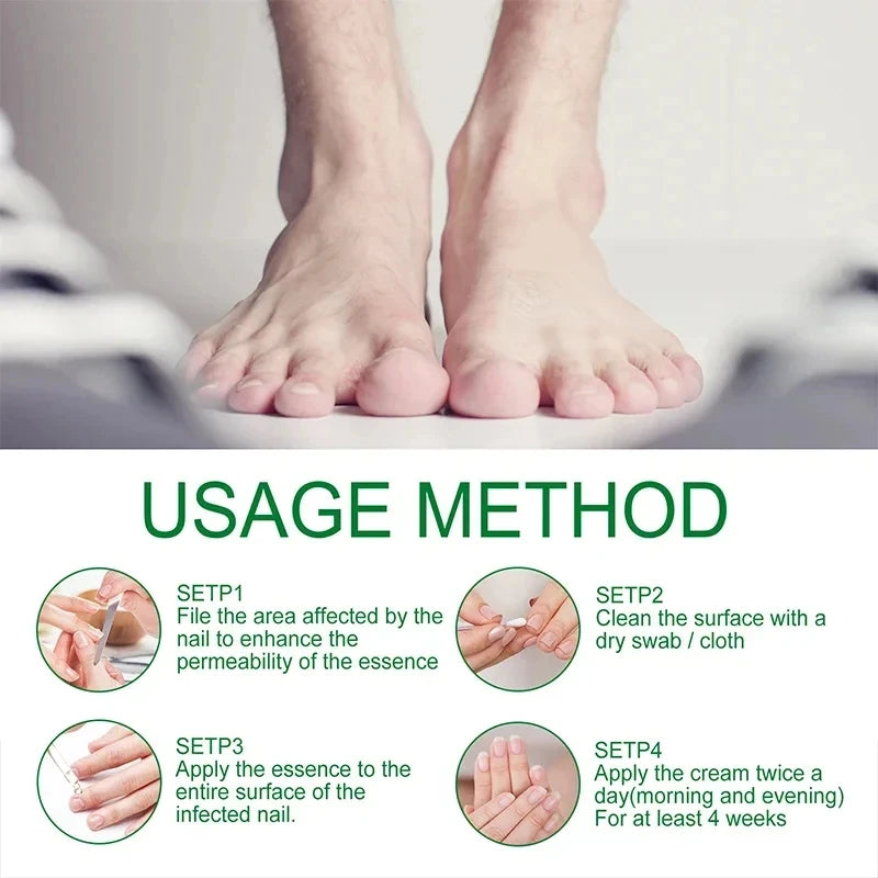 7 Days Nail Fungal Treatment Essence Oil Foot