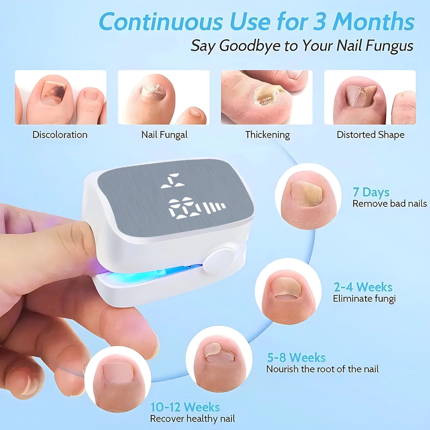 Nail Fungus Treatment Tool