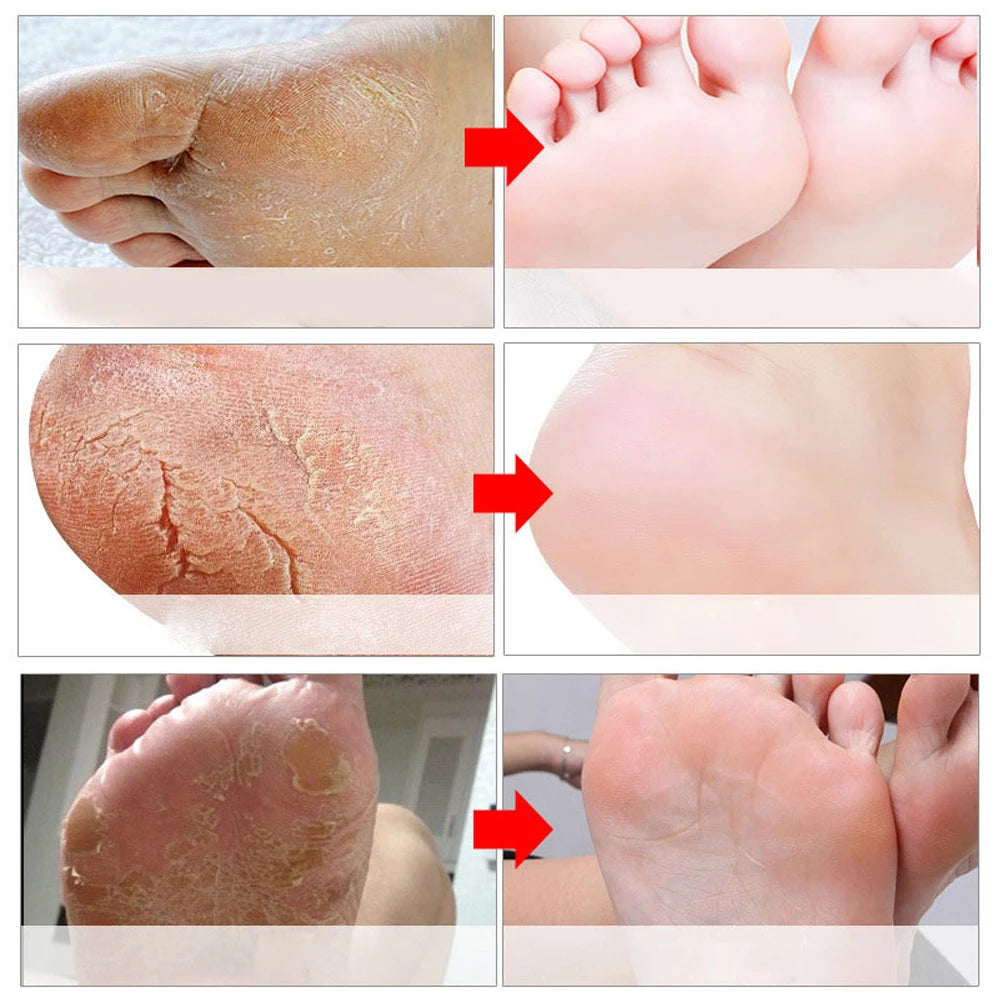 Electric Foot File Grinder – Callus & Dead Skin Remover, SPA Exfoliating Tool for Hard, Cracked Skin Care