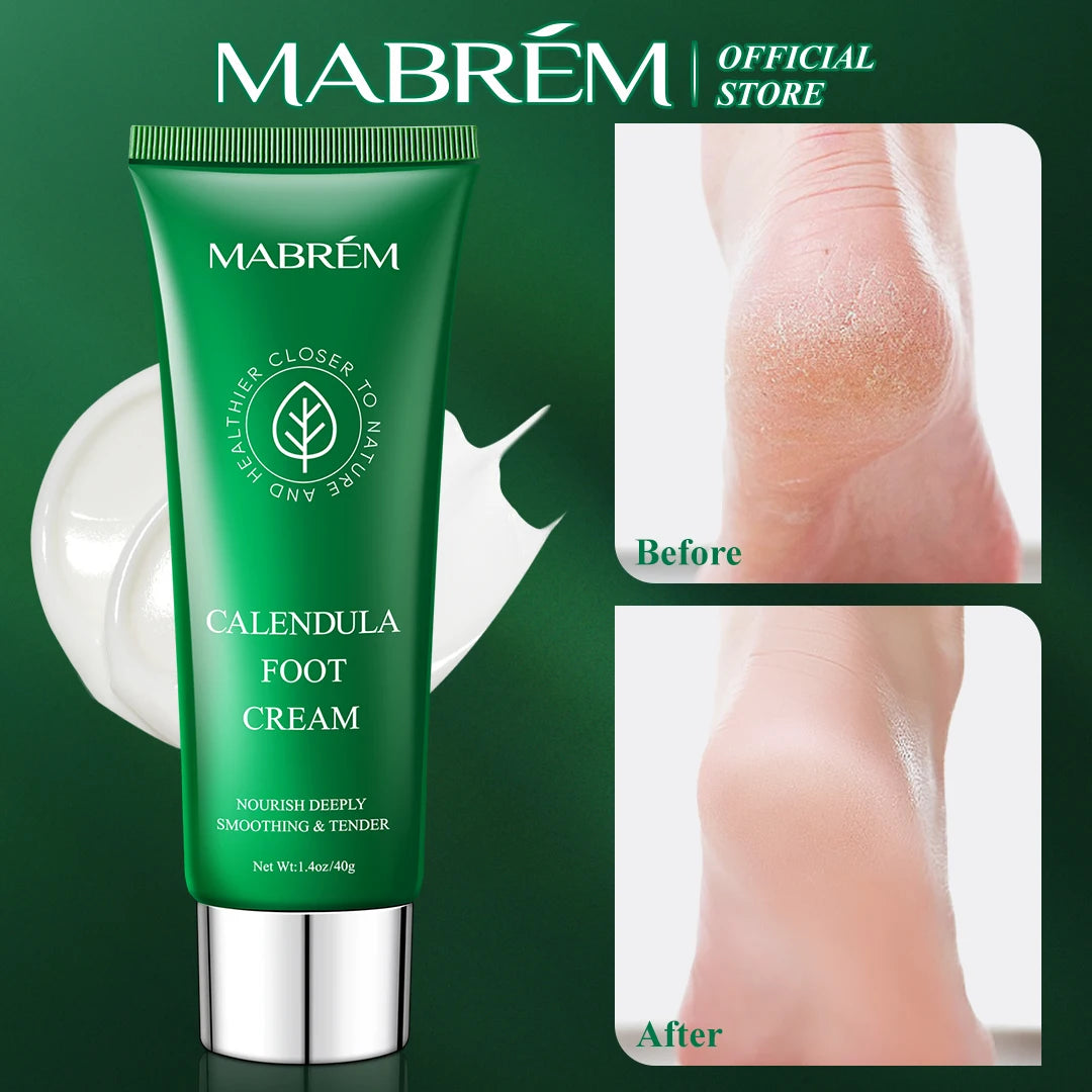MABREM Foot Treatment Cream (Whitening, Anti-cracking, Moisturizing, Relive Pain)