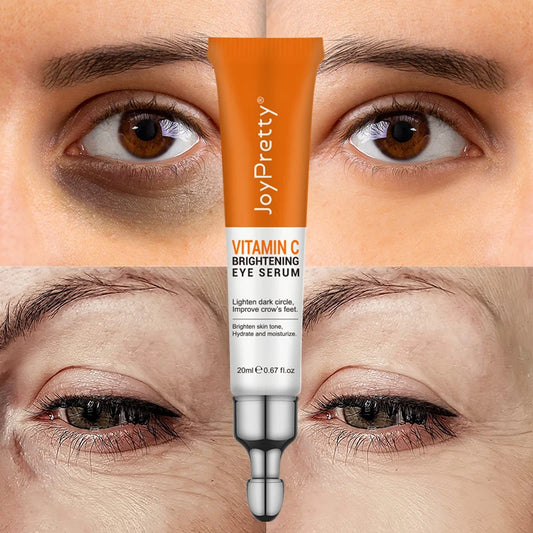 JoyPretty Anti-Dark Circle Eye Cream – Firming & Whitening, Wrinkle Removal Serum for Eyes