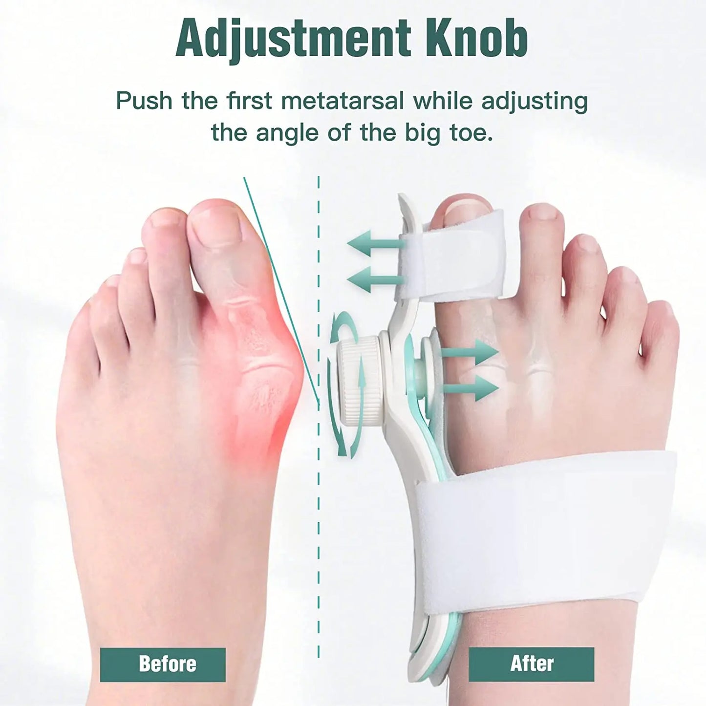 Foot Care Bunion Corrector - Orthopedic Bunion Splint for Hallux Valgus with Three-Angle Fixation Correction Straightener