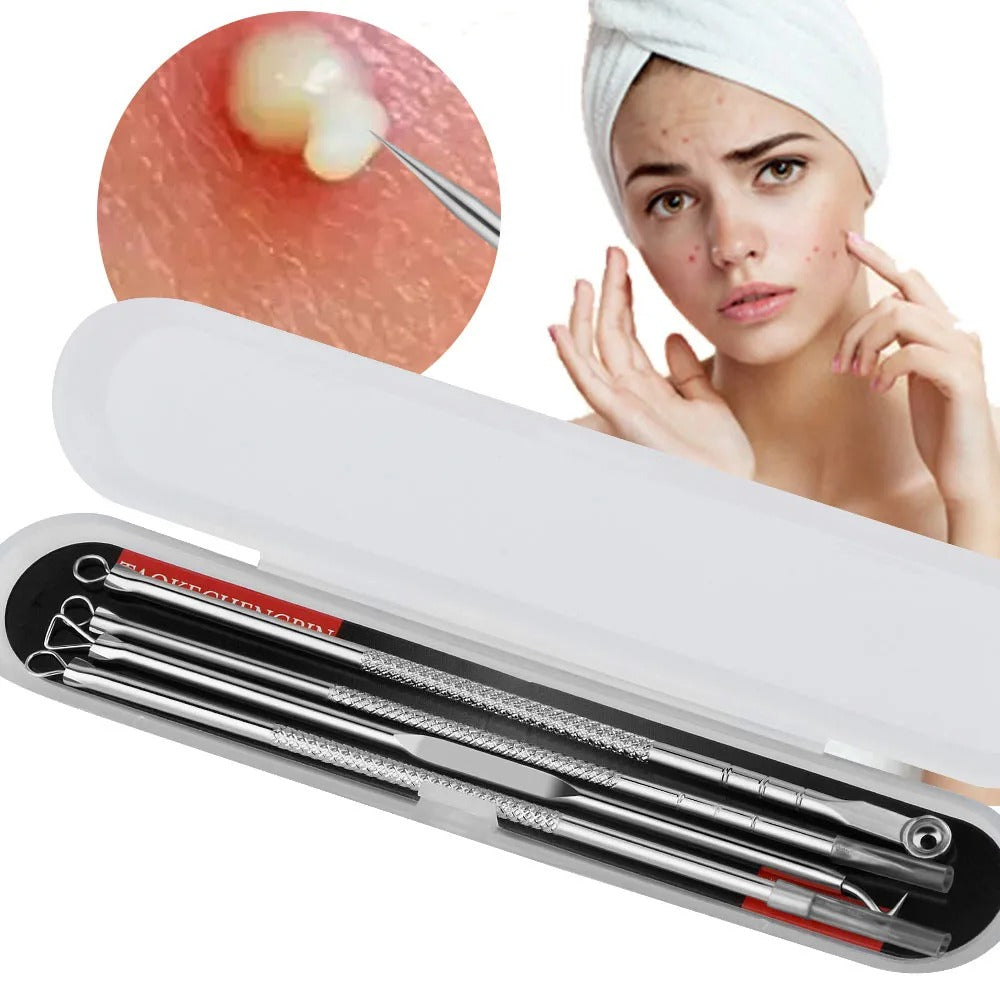 Blackheads/Acne removal kit