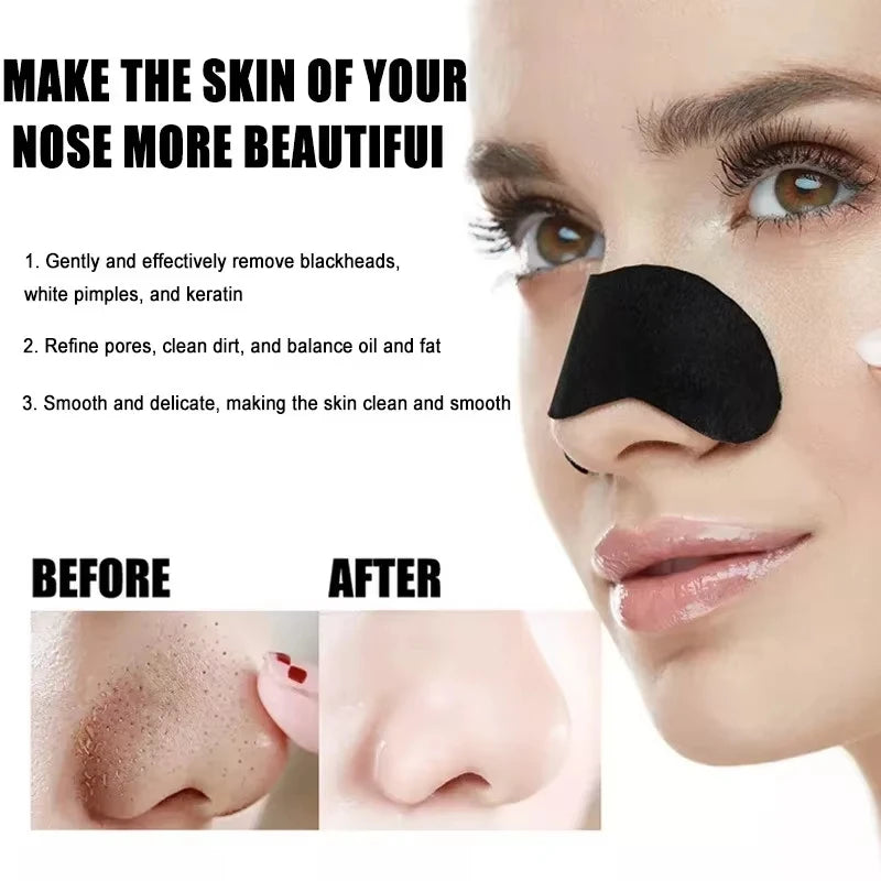 Facial Blackhead Removal Stickers – Pore & Nose Cleansing, Gentle Deep Care (10/50/100 Pieces)