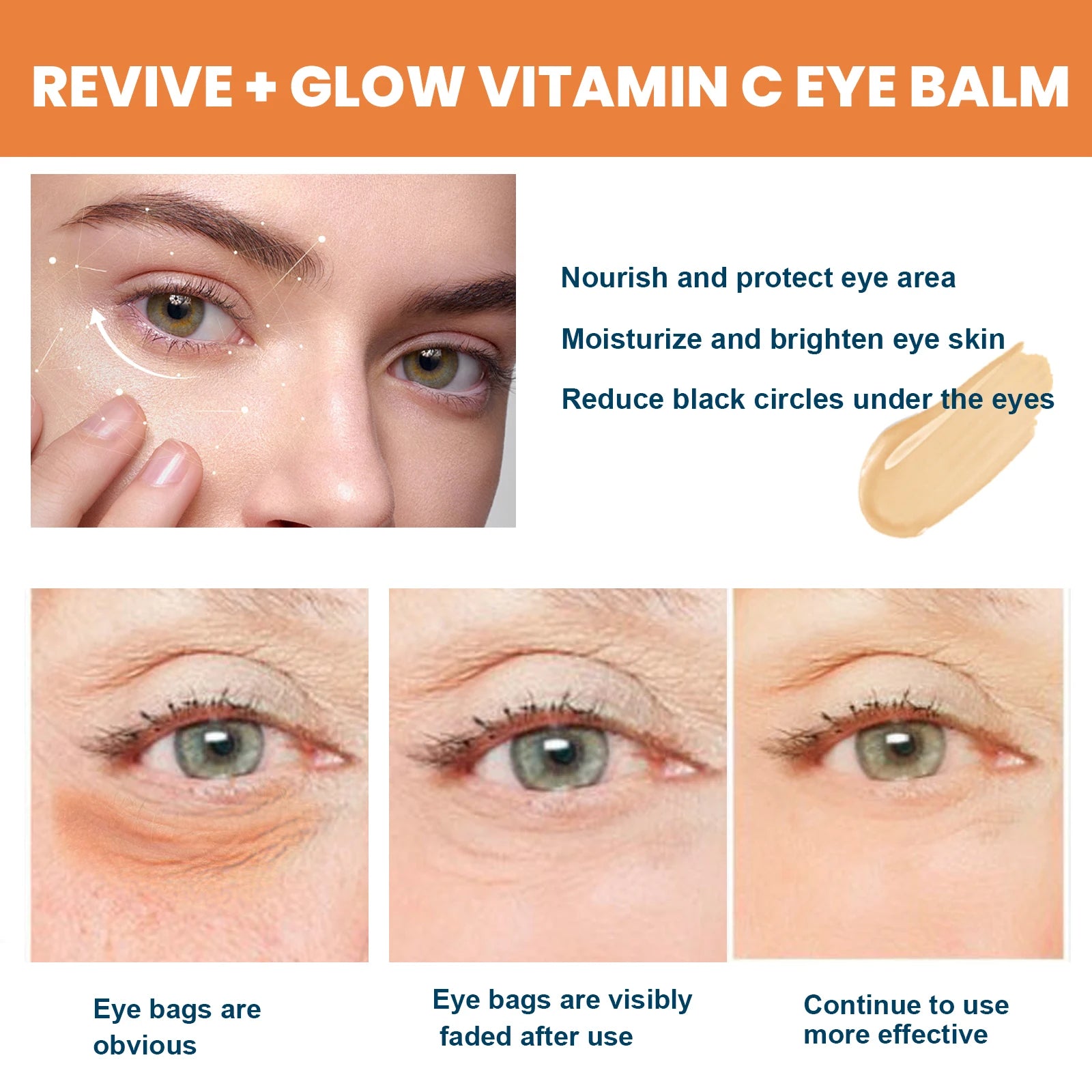 Vitamin C Eye Balm for Dark Circles, Puffiness & Fine Lines