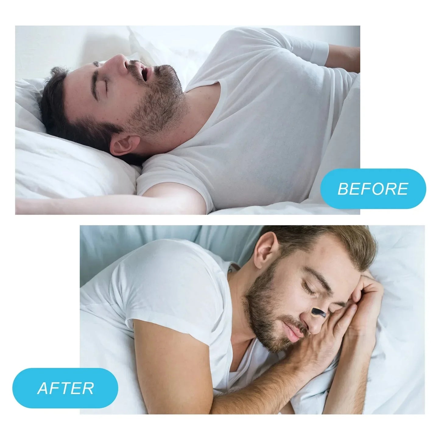 Anti-Snore Nasal Dilator
