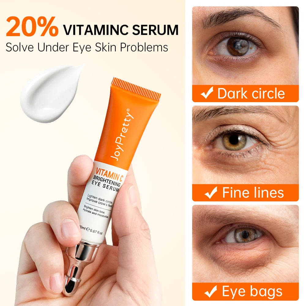 JoyPretty Anti-Dark Circle Eye Cream – Firming & Whitening, Wrinkle Removal Serum for Eyes