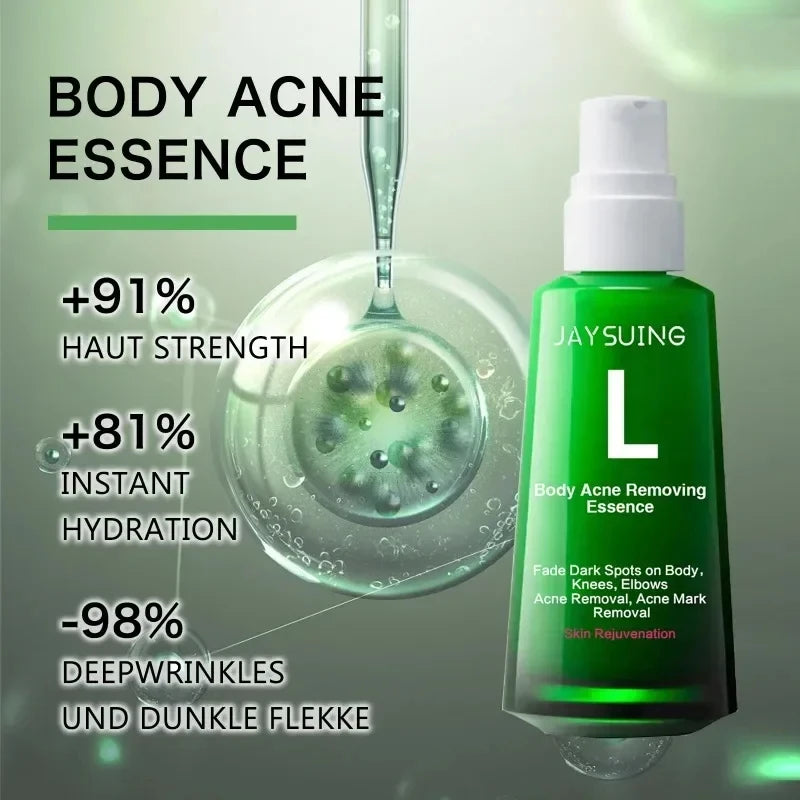 Buttock Acne Removing Serum – Whitening Essence to Fade Acne Scars, Dark Spots & Melanin, Moisturizing Skin Care Lotion