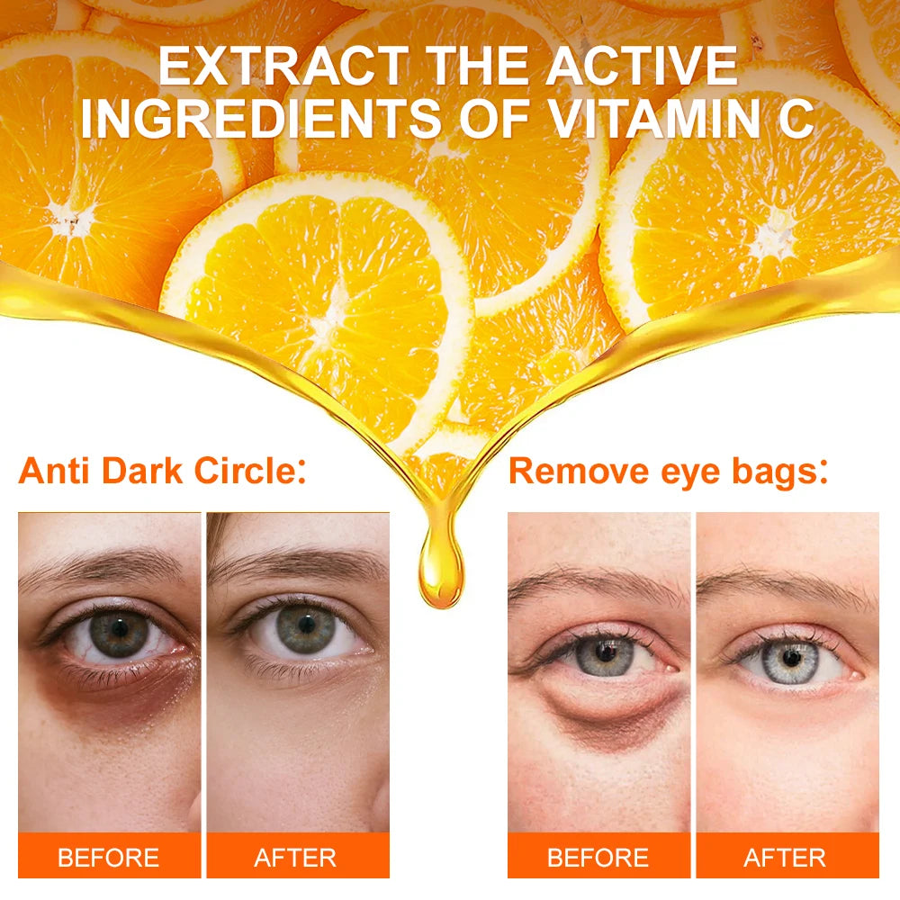 JoyPretty Anti-Dark Circle Eye Cream – Firming & Whitening, Wrinkle Removal Serum for Eyes