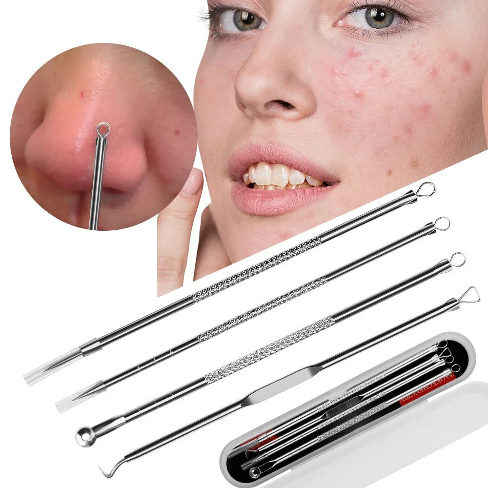 Blackheads/Acne removal kit