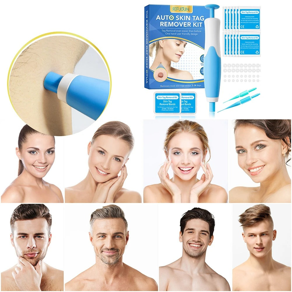 Skin Tag Remover